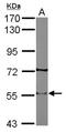 Cholinergic Receptor Nicotinic Beta 2 Subunit antibody, NBP2-15040, Novus Biologicals, Western Blot image 