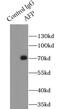 Alpha Fetoprotein antibody, FNab00203, FineTest, Immunoprecipitation image 