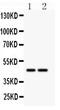 Solute Carrier Family 30 Member 4 antibody, PA2191, Boster Biological Technology, Western Blot image 