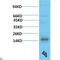 Transthyretin antibody, LS-C813249, Lifespan Biosciences, Western Blot image 
