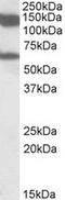 MLLT10 Histone Lysine Methyltransferase DOT1L Cofactor antibody, LS-C112989, Lifespan Biosciences, Western Blot image 