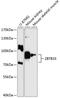 Zinc Finger And BTB Domain Containing 33 antibody, A04754, Boster Biological Technology, Western Blot image 