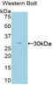 Eukaryotic Translation Initiation Factor 2 Alpha Kinase 2 antibody, LS-C296128, Lifespan Biosciences, Western Blot image 