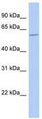 Golgi Associated PDZ And Coiled-Coil Motif Containing antibody, TA336074, Origene, Western Blot image 