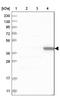 Tweety Family Member 1 antibody, NBP1-85992, Novus Biologicals, Western Blot image 