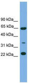 Trafficking Protein Particle Complex 5 antibody, TA337765, Origene, Western Blot image 