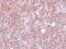 Ankyrin Repeat And KH Domain Containing 1 antibody, GTX115568, GeneTex, Immunohistochemistry paraffin image 