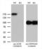 EGFR antibody, LS-C796752, Lifespan Biosciences, Western Blot image 