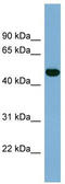 Iroquois-class homeodomain protein IRX-1 antibody, TA342479, Origene, Western Blot image 