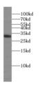 Sulfatase Modifying Factor 2 antibody, FNab08388, FineTest, Western Blot image 