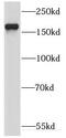 Kinesin-like protein KIF17 antibody, FNab04552, FineTest, Western Blot image 