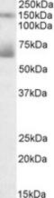 Mesothelin antibody, LS-C112914, Lifespan Biosciences, Western Blot image 