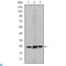 Eukaryotic Translation Initiation Factor 4E antibody, LS-C812578, Lifespan Biosciences, Enzyme Linked Immunosorbent Assay image 