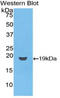 CD59 Molecule (CD59 Blood Group) antibody, LS-C296089, Lifespan Biosciences, Western Blot image 