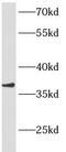 Ankyrin repeat domain-containing protein 1 antibody, FNab00404, FineTest, Western Blot image 