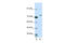 Exosome Component 10 antibody, 29-224, ProSci, Western Blot image 