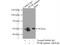 Peroxisome Proliferator Activated Receptor Gamma antibody, 16643-1-AP, Proteintech Group, Immunoprecipitation image 