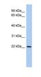 Putative zinc finger protein 833 antibody, orb325574, Biorbyt, Western Blot image 