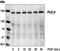 1-phosphatidylinositol-4,5-bisphosphate phosphodiesterase gamma-1 antibody, GTX30787, GeneTex, Western Blot image 