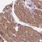 LRAT Domain Containing 2 antibody, NBP2-47459, Novus Biologicals, Immunohistochemistry paraffin image 