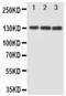 Mitogen-Activated Protein Kinase Kinase Kinase 1 antibody, LS-C313059, Lifespan Biosciences, Western Blot image 