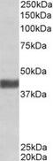 F-Box Protein 32 antibody, MBS421930, MyBioSource, Western Blot image 