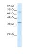 Acyl-CoA Dehydrogenase Medium Chain antibody, orb329691, Biorbyt, Western Blot image 