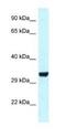 Hes Related Family BHLH Transcription Factor With YRPW Motif 1 antibody, NBP1-82377, Novus Biologicals, Western Blot image 