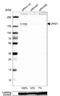 Leucine Rich Repeats And Immunoglobulin Like Domains 1 antibody, NBP2-30926, Novus Biologicals, Western Blot image 