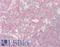 C-Terminal Src Kinase antibody, LS-B14204, Lifespan Biosciences, Immunohistochemistry paraffin image 