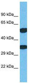 Transmembrane Protein 68 antibody, TA330779, Origene, Western Blot image 