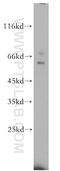 Killer Cell Immunoglobulin Like Receptor, Two Ig Domains And Long Cytoplasmic Tail 3 antibody, 18966-1-AP, Proteintech Group, Western Blot image 