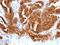 TAG-72 antibody, MBS438213, MyBioSource, Immunohistochemistry frozen image 