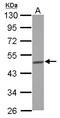 Branched Chain Keto Acid Dehydrogenase E1 Subunit Alpha antibody, LS-B12367, Lifespan Biosciences, Western Blot image 
