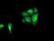 Isocitrate Dehydrogenase (NAD(+)) 3 Alpha antibody, GTX84318, GeneTex, Immunofluorescence image 