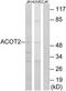 Acyl-CoA Thioesterase 2 antibody, TA315131, Origene, Western Blot image 