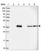 ALG2 Alpha-1,3/1,6-Mannosyltransferase antibody, NBP1-85715, Novus Biologicals, Western Blot image 