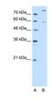 Carnitine O-Octanoyltransferase antibody, orb330569, Biorbyt, Western Blot image 