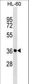 Zinc Finger Protein 785 antibody, LS-C157511, Lifespan Biosciences, Western Blot image 