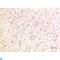 Phosphoinositide-3-Kinase Regulatory Subunit 1 antibody, LS-C813239, Lifespan Biosciences, Immunohistochemistry paraffin image 