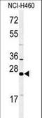 RAB27B, Member RAS Oncogene Family antibody, LS-C162374, Lifespan Biosciences, Western Blot image 