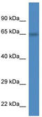 Peroxisomal Biogenesis Factor 5 Like antibody, TA345010, Origene, Western Blot image 