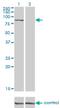 Discs Large MAGUK Scaffold Protein 3 antibody, H00001741-M03, Novus Biologicals, Western Blot image 