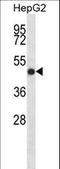 Indian Hedgehog Signaling Molecule antibody, LS-C165164, Lifespan Biosciences, Western Blot image 