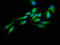 HECT Domain E3 Ubiquitin Protein Ligase 2 antibody, LS-C672384, Lifespan Biosciences, Immunofluorescence image 