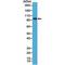 B-Raf Proto-Oncogene, Serine/Threonine Kinase antibody, M00075-2, Boster Biological Technology, Western Blot image 