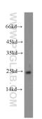 Guanylate Cyclase Activator 1A antibody, 12944-1-AP, Proteintech Group, Western Blot image 
