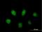 Poly(ADP-Ribose) Polymerase Family Member 3 antibody, H00010039-B01P, Novus Biologicals, Immunofluorescence image 