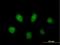 Poly [ADP-ribose] polymerase 3 antibody, H00010039-B01P, Novus Biologicals, Immunofluorescence image 