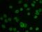Translocated Promoter Region, Nuclear Basket Protein antibody, A00695-2, Boster Biological Technology, Immunofluorescence image 